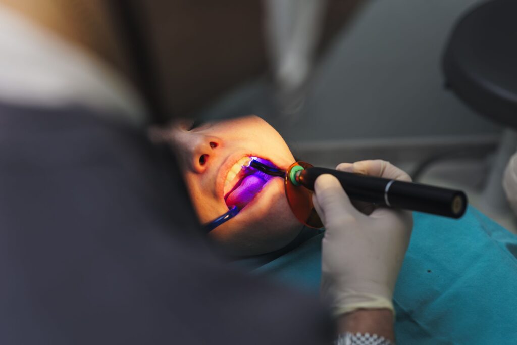 Lampada polimerizzatrice Lampada polimerizzatrice