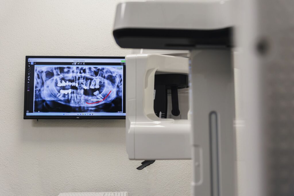 OPT dettaglio OPT dettaglio